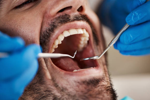 Best Urgent Dental Care for Toothache in Mount Hermon, CA