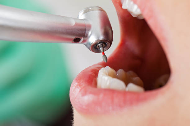 Best Mobile Emergency Dentist in Mount Hermon, CA